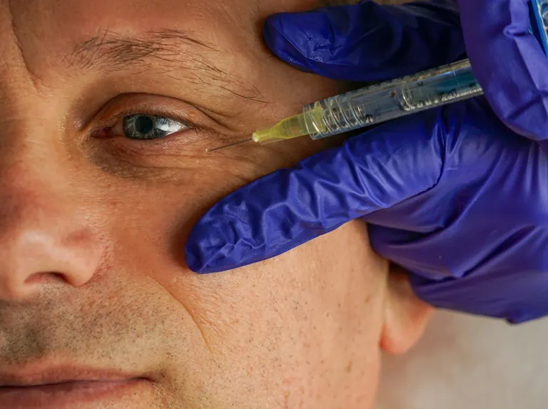 A gloved clinician holding a fine-gauge syringe beside the outer corner of a man's eye, with his eyebrow and upper eyelid in view