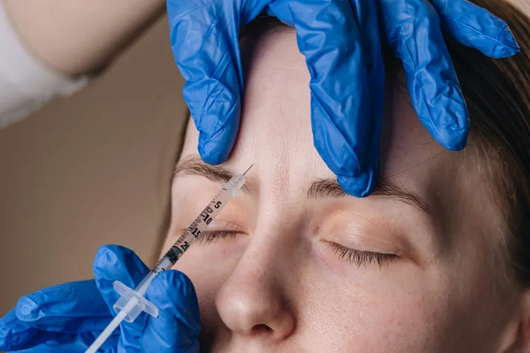 A gloved injector placing an injection into the glabellar complex between the eyebrows while the patient keeps their eyes closed
