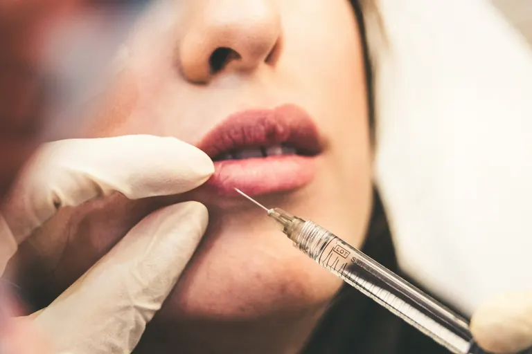 A gloved clinician injecting dermal filler into a patient’s lower lip in profile